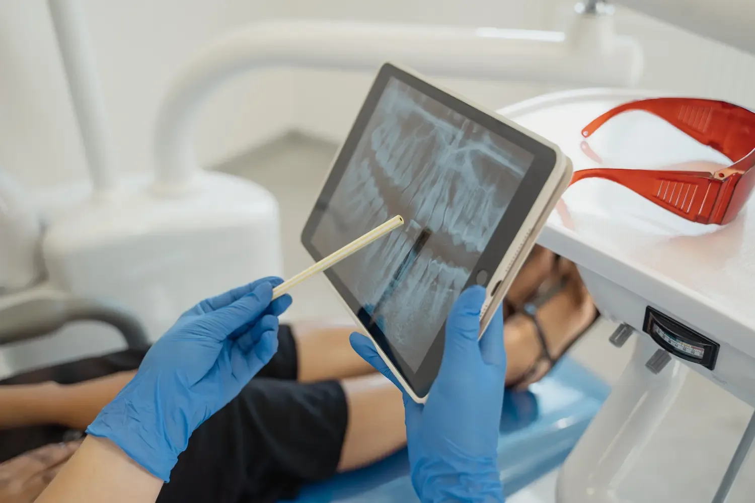 Root Canal Therapy in Louisville, KY